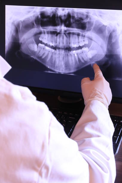Best Emergency Root Canal Therapy in New Plymouth, ID