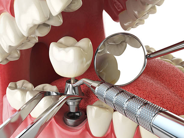 Best Emergency Orthodontic Repairs in New Plymouth, ID